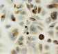 Anti-HYAL1 Antibody